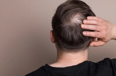 First long-acting hair regrowth pill hailed as 'new benchmark'